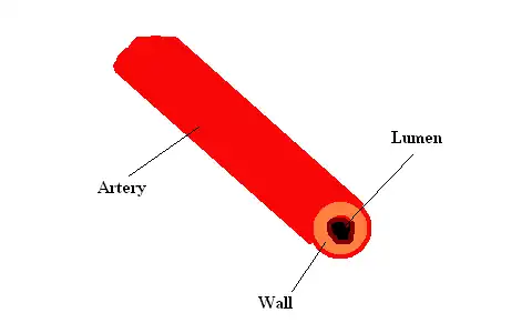 This is a very basic illustration showing what your arteries look like
