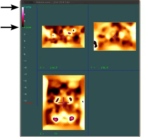 Display overlaying images transparency step 1 MINC toolkit