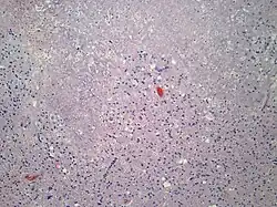 Intermediate power microscopy