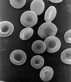 red blood cells contain hemoglobin