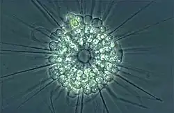 Actinophrys sol, living heliozoon