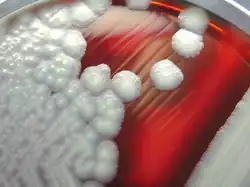 "B. cereus" colonies on a sheep-blood agar plate