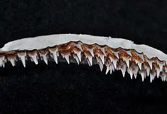 Upper teeth