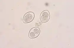 Coccidia oocysts in a fecal flotation from a cat. The cat was underweight and had diarrhea, showing signs of coccidiosis.
