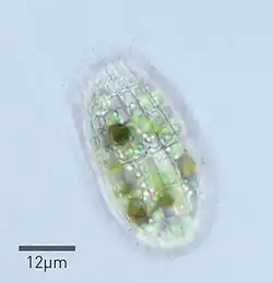 Micrograph of a Coleps specimen