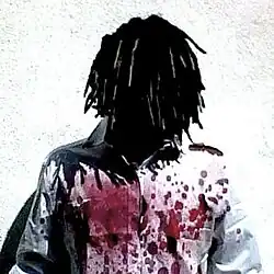 A low-quality photo of Carson in a bloodied white shirt against a white background