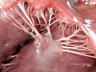 Papillary muscles and chordae tendineae