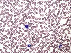 Normal human blood film