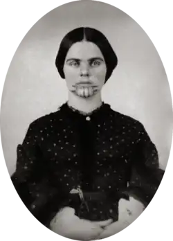 A black and white picture of a woman with a tattoo on her chin