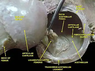 Hip joint. Lateral view. Acetabulum.