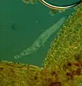Spirostomum teres - 160x