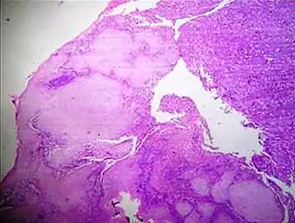 Staining artifacts by residual wax, resulting in pale areas where cellular structures are not discernible