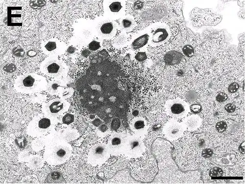 Electron micrograph of virus factory in an amoeba co-infected with Zamilon and Mont1 (scale bar: 0.1 μm)