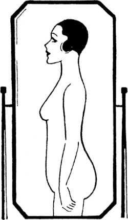 Lordosis